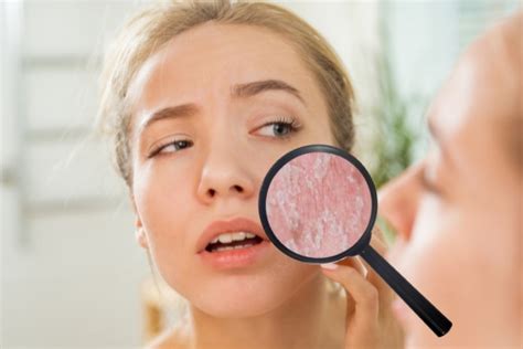 What Causes Dead Skin Cell Build Up And How Can You Treat It