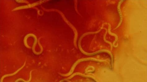 Worms Sex Life Yields Advantage Over Parasites Bbc News