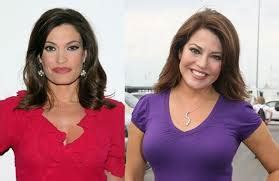 Kimberly Guilfoyle Plastic Surgery Before After