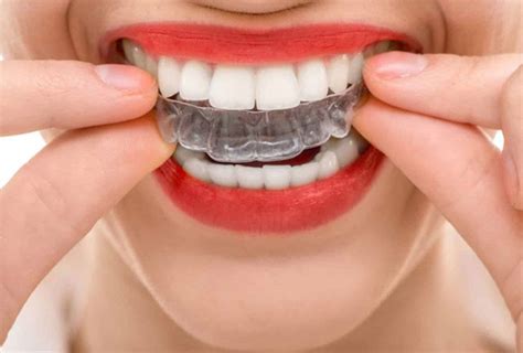 What Is Invisalign Langmore Dental Berwick Dentist
