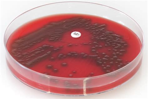 Streptococcus Pneumoniae Mucoid Strain Columbia Horse Blood Agar