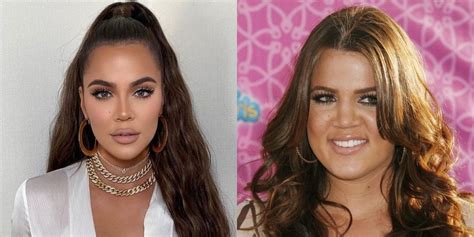 did khloé kardashian get a nose job face before and after