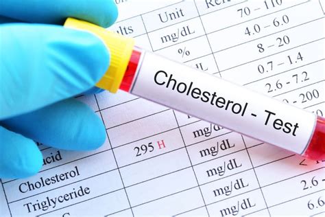 Foto Kadar Kolesterol Normal Berdasarkan Usia Yang Perlu Diketahui