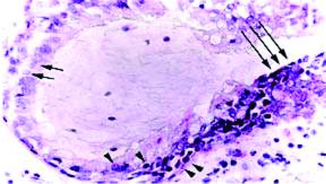 Cross Section Of A Small Bronchiole In Human Lung Stained For Hnrnp