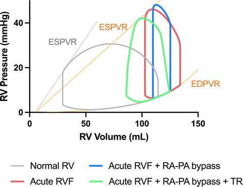 Pressure Volume Loops Reflecting The Impact Of Tricuspid Regurgitation