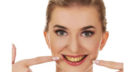 5 Foods That Turn Your Teeth Yellow Dentree Dental Studio