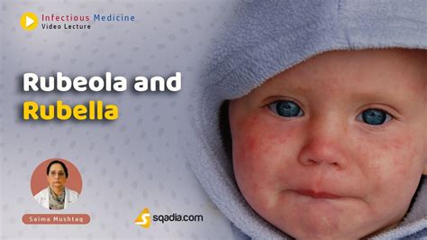 Rubeola And Rubella Preview Infectious Medicine Youtube