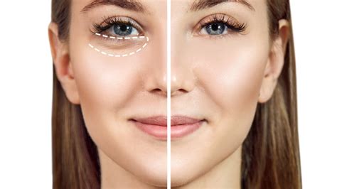 How To Remove Bags Under Eyes Permanently Or Instantly On Photo Perfect