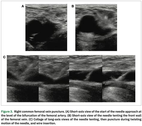 Integrating Long Axis And Short Axis Views With A Twist For Ultrasound