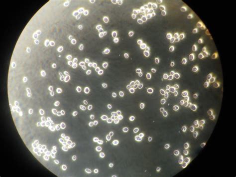 Saccharomyces Cerevisiae Under Light Microscope