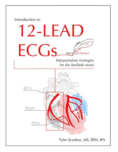 Introduction To 12 Lead Ecgs Interpretation Strategies For The Bedside