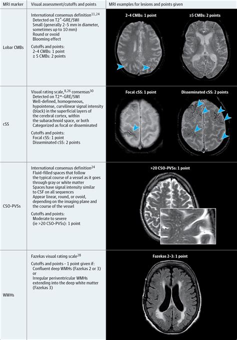 Total Magnetic Resonance Imaging Burden Of Small Vessel Disease In