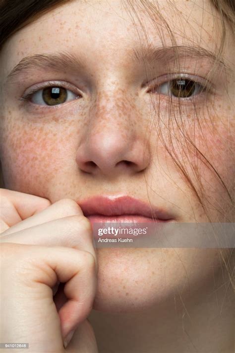 Tight Portrait Of A Teenage Girl With Pale Skin And Freckles Resting