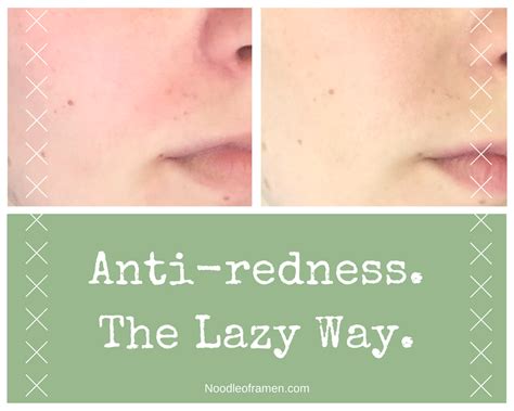 Get Rid Of Facial Redness The Cheap And Lazy Way Redness Redness