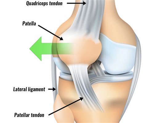 Hip Weakness Causes Knee Pain CORE Omaha Explains C O R E Physical Therapy And Sports