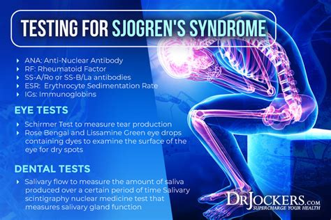 Sjogrens Syndrome Symptoms Causes And Support Strategies