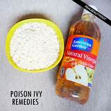 Home Remedies For Poison Oak Bleach Photos