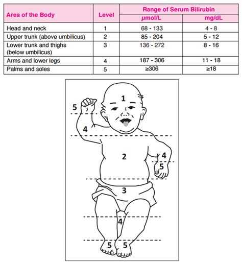 Normal Jaundice Levels In Newborns Chart