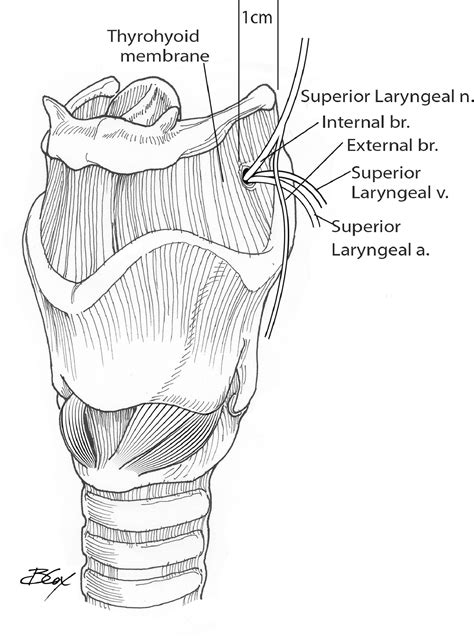 Open Surgical Approach To Laryngoceles And Saccular Cysts Operative