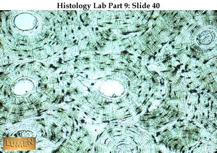 Using clear epox glue, bind the section to the microscope glass slide. موقع الدكتور أحمد كلحى: Histology slide - Specialized ...