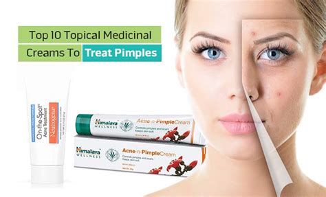 Top 10 Topical Medicinal Creams To Treat Pimples Healthoduct