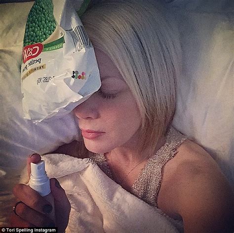 Tori Spelling Shares Snap With Frozen Peas On Her Face As She Endures