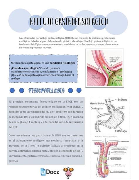 Reflujo Gastroesof Gico Cerebrosidos Med Cerebrosidos Med Udocz