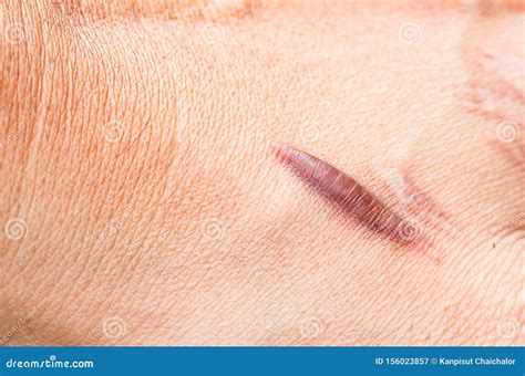 The Hand Of An Accidental Farmer Under A Big Straw Bale Royalty-Free