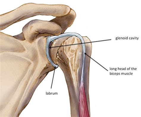 The shoulder joint is a ball and socket joint. Labral tear - SLAP lesion