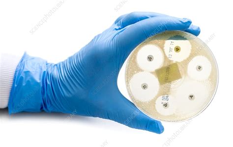 Antibiotic Sensitivity Test Stock Image C0232949 Science Photo