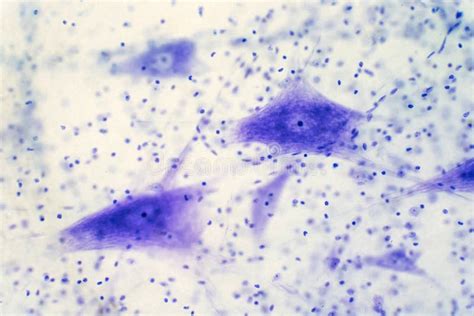 Neurons Cells From The Brain Under The Microscope View Stock Photo