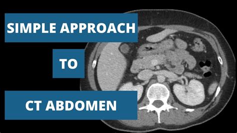 How To Read A Ct Abdomen Part 2 Youtube