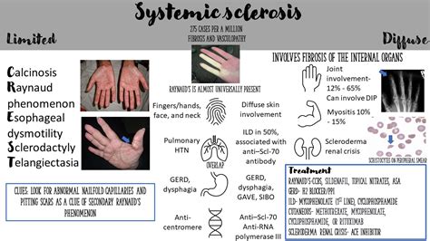 Systemic Sclerosis (Scleroderma) Limited - CREST: | GrepMed