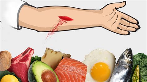Top 5 Foods To Heal Wounds Faster