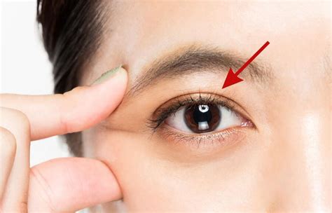 What Are Chinese Double Eyelids