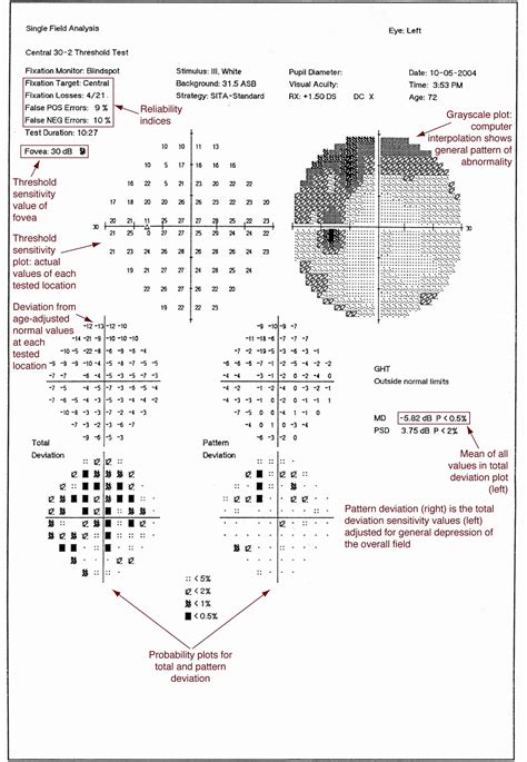 Static Perimetry American Academy Of Ophthalmology