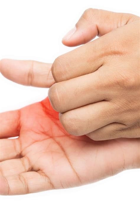 Right palm itching = you will receive some money very shortly. Itchy palms: 6 causes, treatment, and prevention
