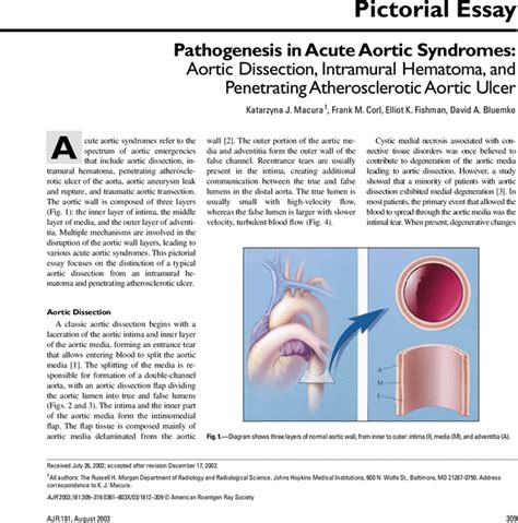 Pathogenesis In Acute Aortic Syndromes Aortic Dissection Intramural