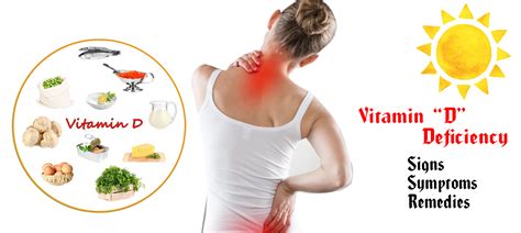 Vitamin D Deficiency Signs Symptoms And Treatment Food Nutrition