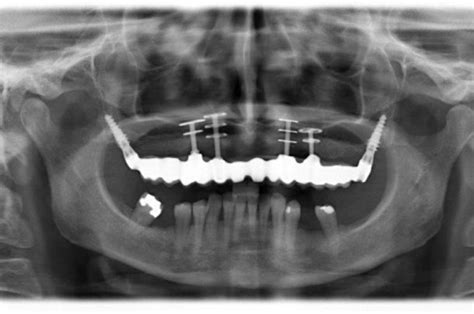 Store opening hours, closing time, address, phone number, directions. Radiografie digitali dentali #Denti #dentisti #Radiografia ...