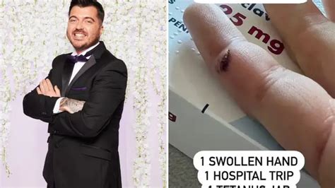 Married At First Sight Uk Star Luke Worley 31 Needed A Tetanus Jab After Man Tried To Lbc