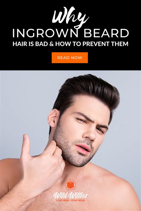 They may be hard or soft to touch and are likely filled with pus. Why Ingrown Beard Hair Is Bad And How to Prevent Them ...
