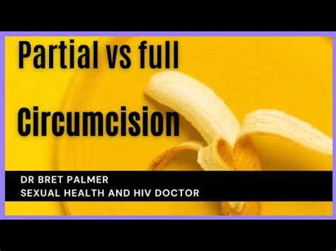 Partial Vs Full Circumcision Explained YouTube