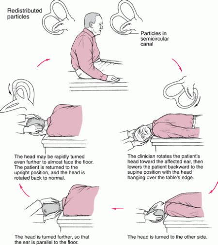 Epley Maneuver Used By Chiropractors For Bppv In El Paso Tx