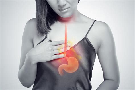 heartburn acid reflux and gerd what s the difference