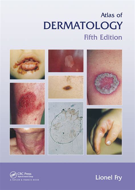 Atlas Of Dermatology Fifth Edition 5th Edition Lionel Fry Rout