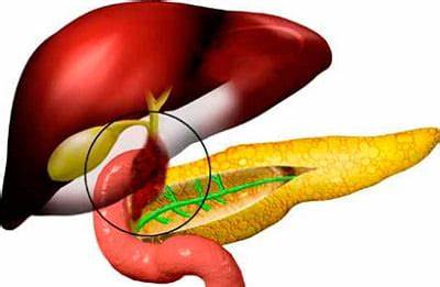 Дискинезия желчевыводящих путей: симптомы, лечение, диета Картинка - Дискинезия желчевыводящих путей: симптомы, лечение, диета