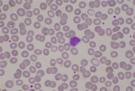 White Blood Cell Lymphocyte On Red Blood Cells Background Stock Image
