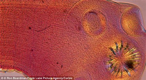 Man with stomach pain excretes a 6.2 METRE tapeworm caused ...