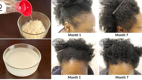 Quick Way To Make Rice Water For Hair Growth Youtube